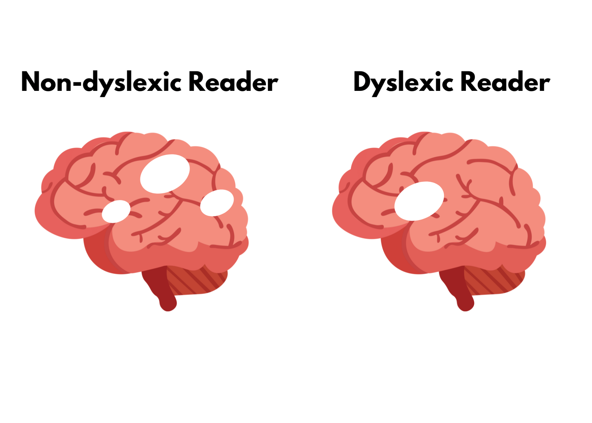 A Guide To Understanding Dyslexia And The Dyslexic Brain My Take On The Book Reading In The 1555